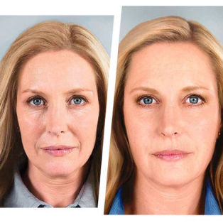 effetto di ringiovanimento degli occhi